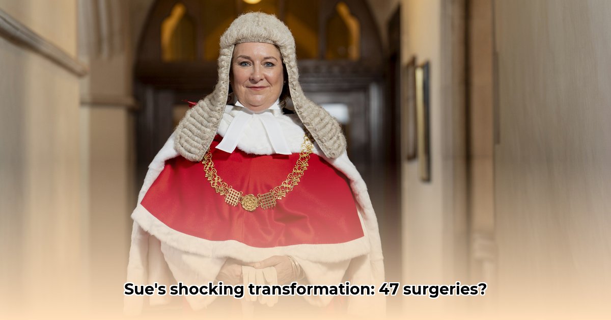 sue-survivor-47-plastic-surgery